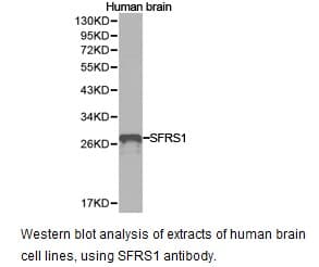 SRSF1 / SF2 Antibody