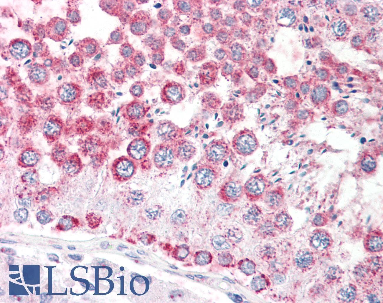 IHC-plus™ CCP110 Antibody