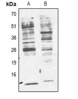 Monoclonal Mouse Phosphotyrosine Antibody (IHC, WB)