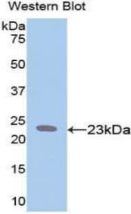 ELN / Elastin Antibody (aa392-645)