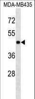 MAPK3 / ERK1 Antibody