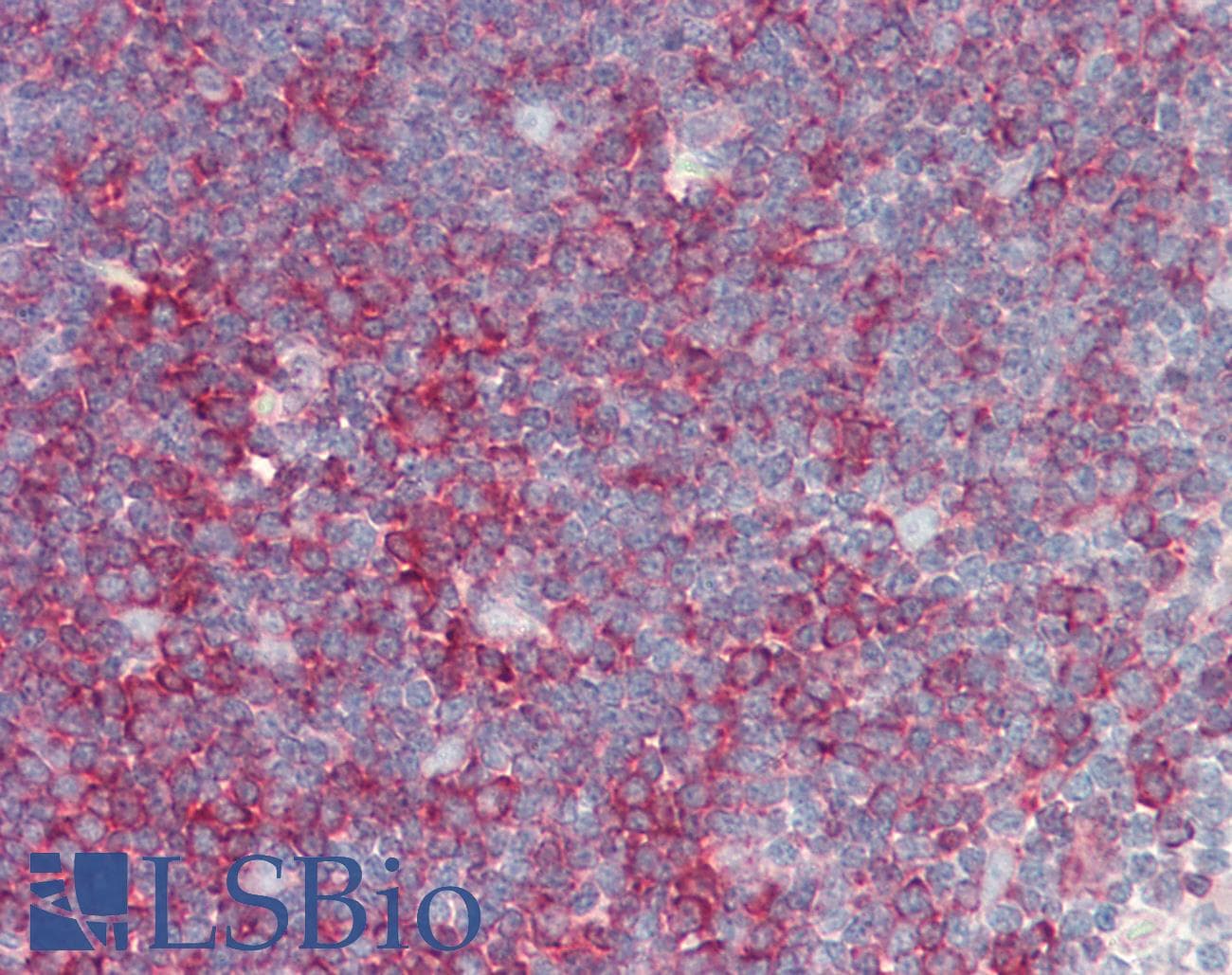 IHC-plus™ Monoclonal Rat anti-Yeast Alpha Tubulin Antibody (clone YOL1/34, IHC, WB)
