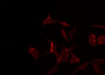Polyclonal Rabbit anti-Human S100A1 / S100-A1 Antibody (IHC, IF, WB)