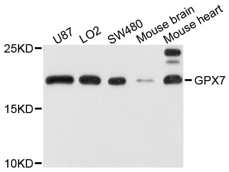 Polyclonal Rabbit anti-Human GPX7 Antibody (WB)