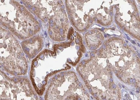 GLUD1/Glutamate Dehydrogenase Antibody