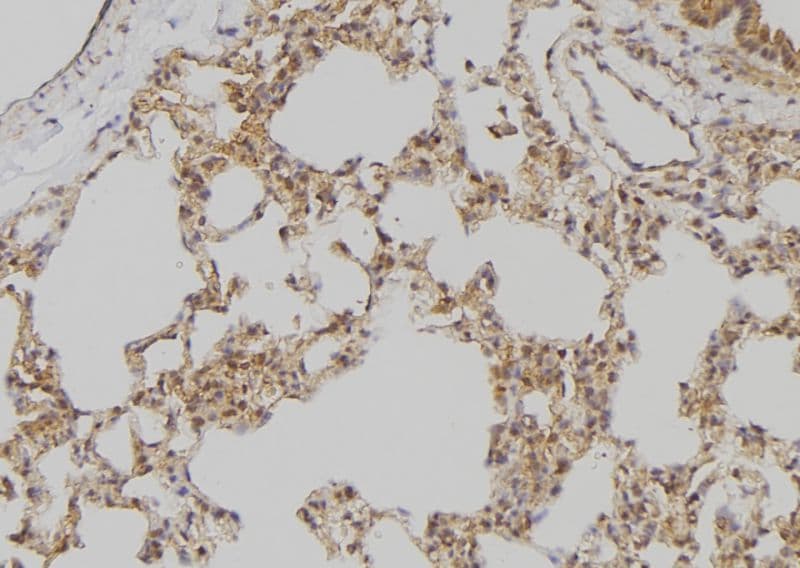 Polyclonal Rabbit anti-Human APOBEC3D Antibody (IHC, IF, WB)