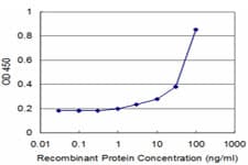 AIMP1 / EMAP II Antibody (clone 3H5)