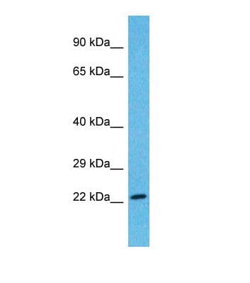 FOXR1 Antibody (N-Terminus)