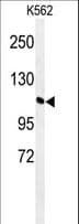 GTF2IRD2 Antibody (aa812-841)
