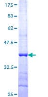 Human HAPLN4 Protein (Recombinant GST, N-terminus)