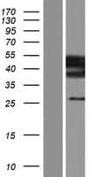 ST3GAL3 / ST3N Protein (Over-Expression Lysate Myc-DDK (Flag))