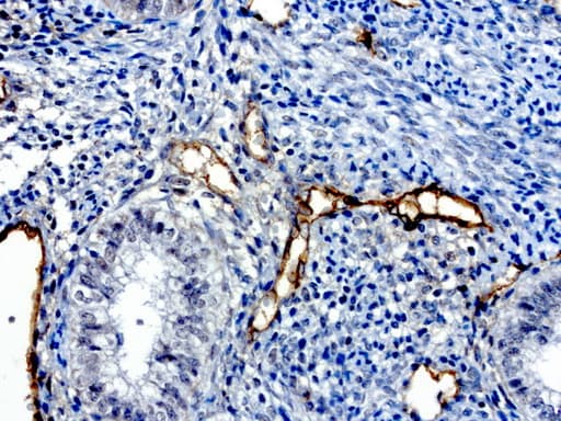 PROCR / EPCR Antibody (aa1-210, clone UMAB200)