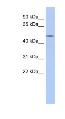 Polyclonal Rabbit anti-Human ETS2 Antibody (aa395-444, WB)