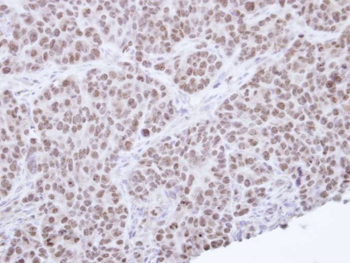 NR0B2 Antibody (aa64-257)