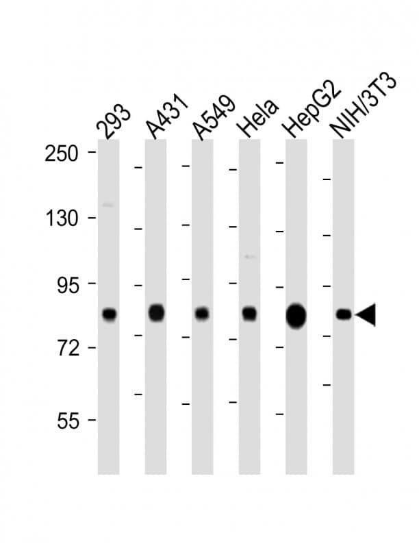 RPS6KA3 / RSK2 Antibody