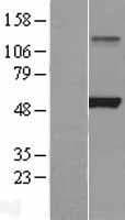 LPL / Lipoprotein Lipase (Over-Expression Lysate Myc-DDK (Flag))