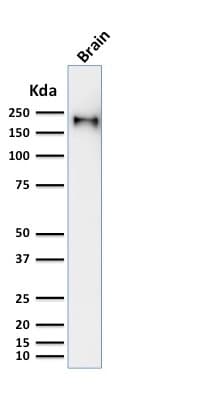 Recombinant Monoclonal Mouse anti-Human NEFH / NF-H Antibody (clone rNF421, Azide-free,Carrier-free, IHC, WB)