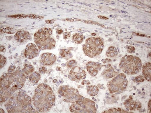 Vps60 / CHMP5 Antibody (clone OTI2E6)