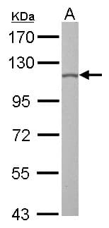 OGT / O-GLCNAC Antibody (aa223-502)