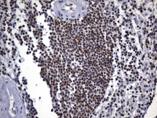 MSH2 Antibody (aa1-304, clone UMAB259)