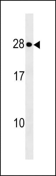 KDELR1 / HDEL Antibody (aa185-211)