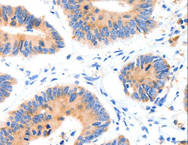 SLC2A4 / GLUT-4 Antibody