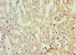 GNL3 / NS / Nucleostemin Antibody (aa1-240)