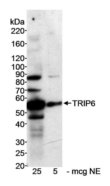 ZRP-1 / TRIP6 Antibody (aa200-250)