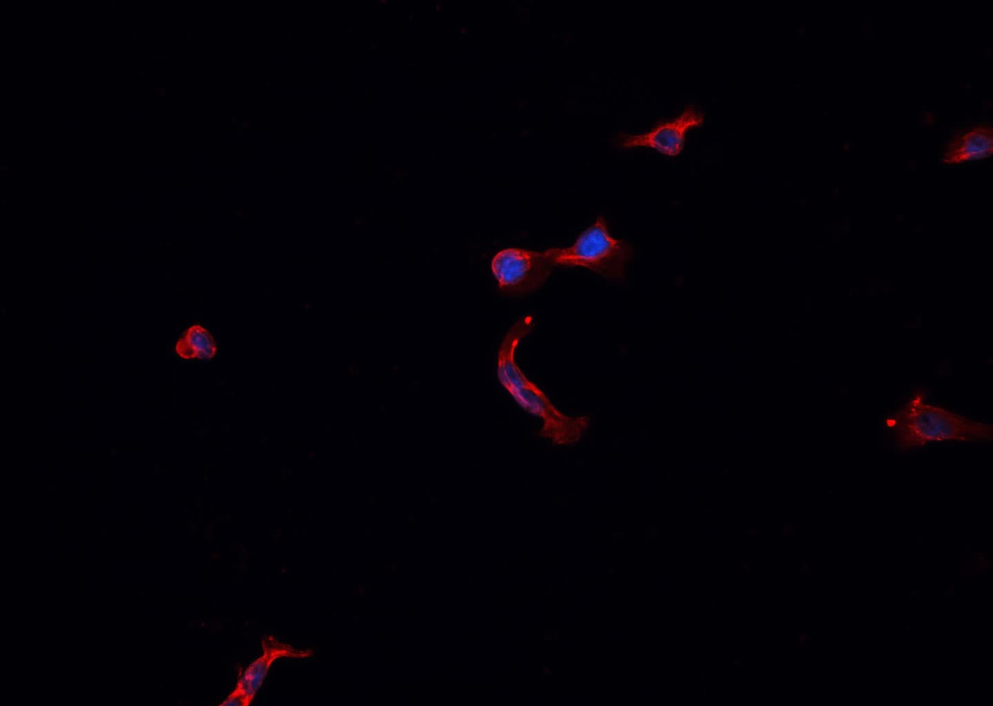 Polyclonal Rabbit anti-Human COX4I2 Antibody (IF, WB)