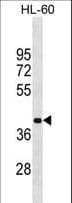 MBD2 Antibody (aa250-279)