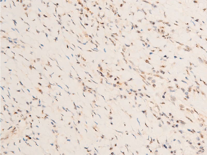 PDPK1 / PDK1 Antibody (phospho-Ser241)