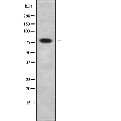 Polyclonal Rabbit anti-Human SETMAR Antibody (WB)