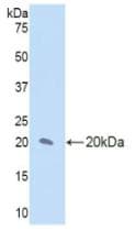 Human IL17RD Protein (Recombinant His, N-Terminal)