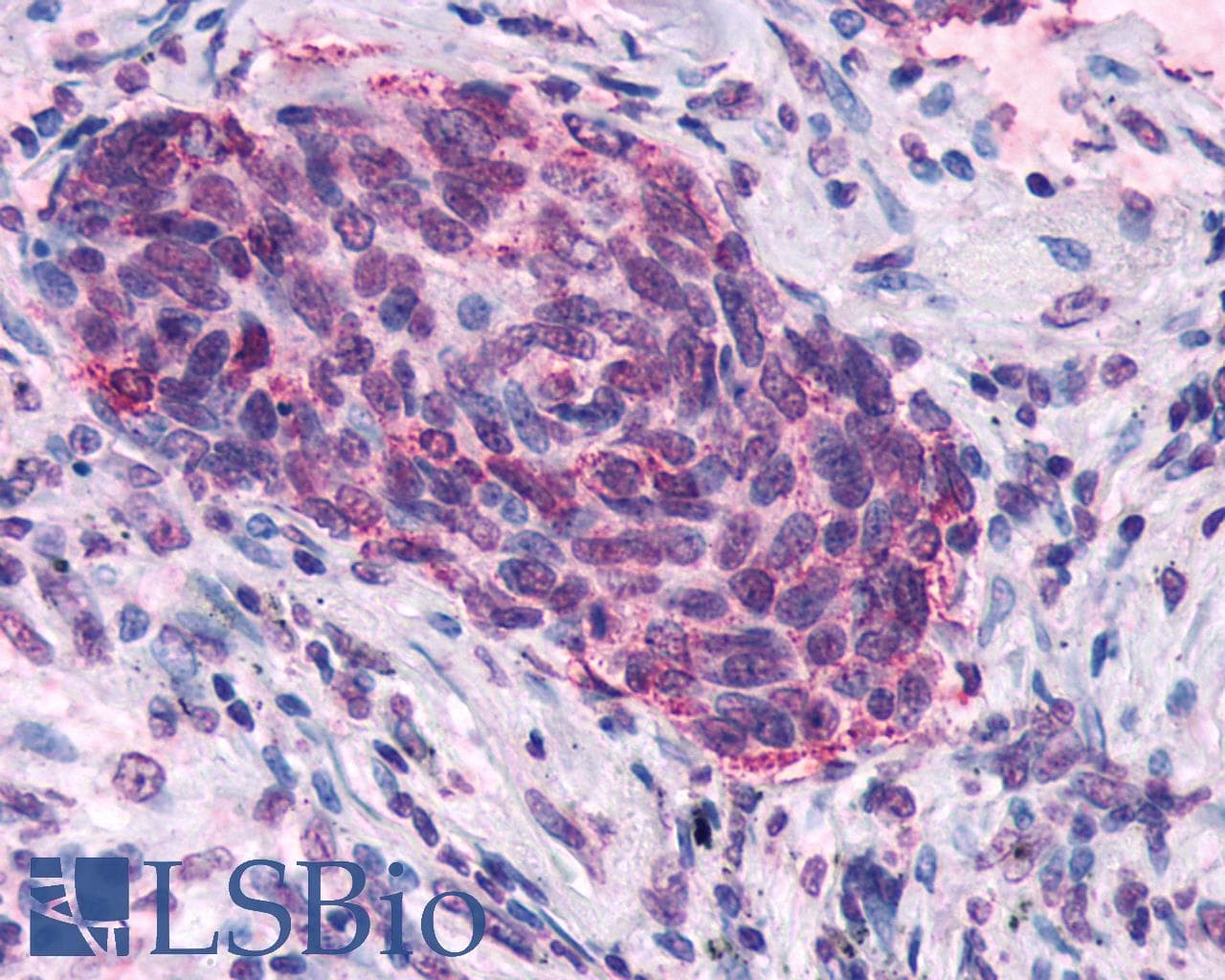 IHC-plus™ SSTR5 Antibody (C-Terminus)