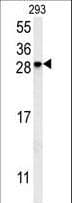 Polyclonal Rabbit anti-Human C5orf15 Antibody (aa123-150, WB)