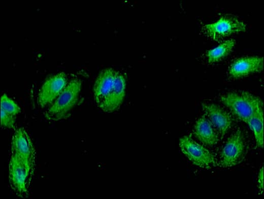 Polyclonal Rabbit anti-Human ALK-6 / BMPR1B Antibody (IHC, IF, WB)