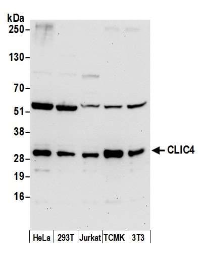 CLIC4 Antibody (aa150-200)
