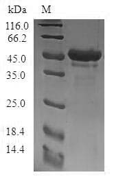 Human STMN4 / RB3 Protein (Recombinant GST, N-terminus)