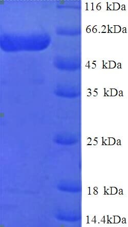 Human MINPP1 Protein (Recombinant His)