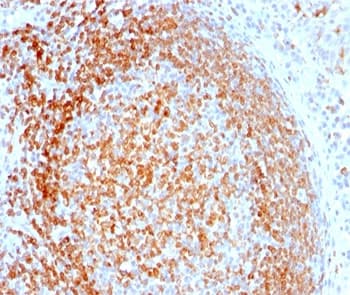 CD74 / CLIP Antibody (clone LN-2, Ready-to-Use)