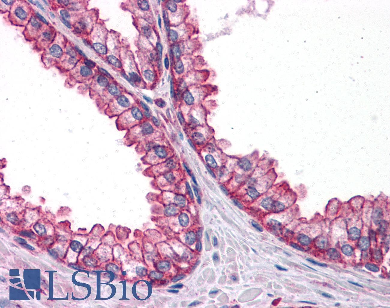 IHC-plus™ Polyclonal Rabbit anti-Human PTER Antibody (IHC, WB)