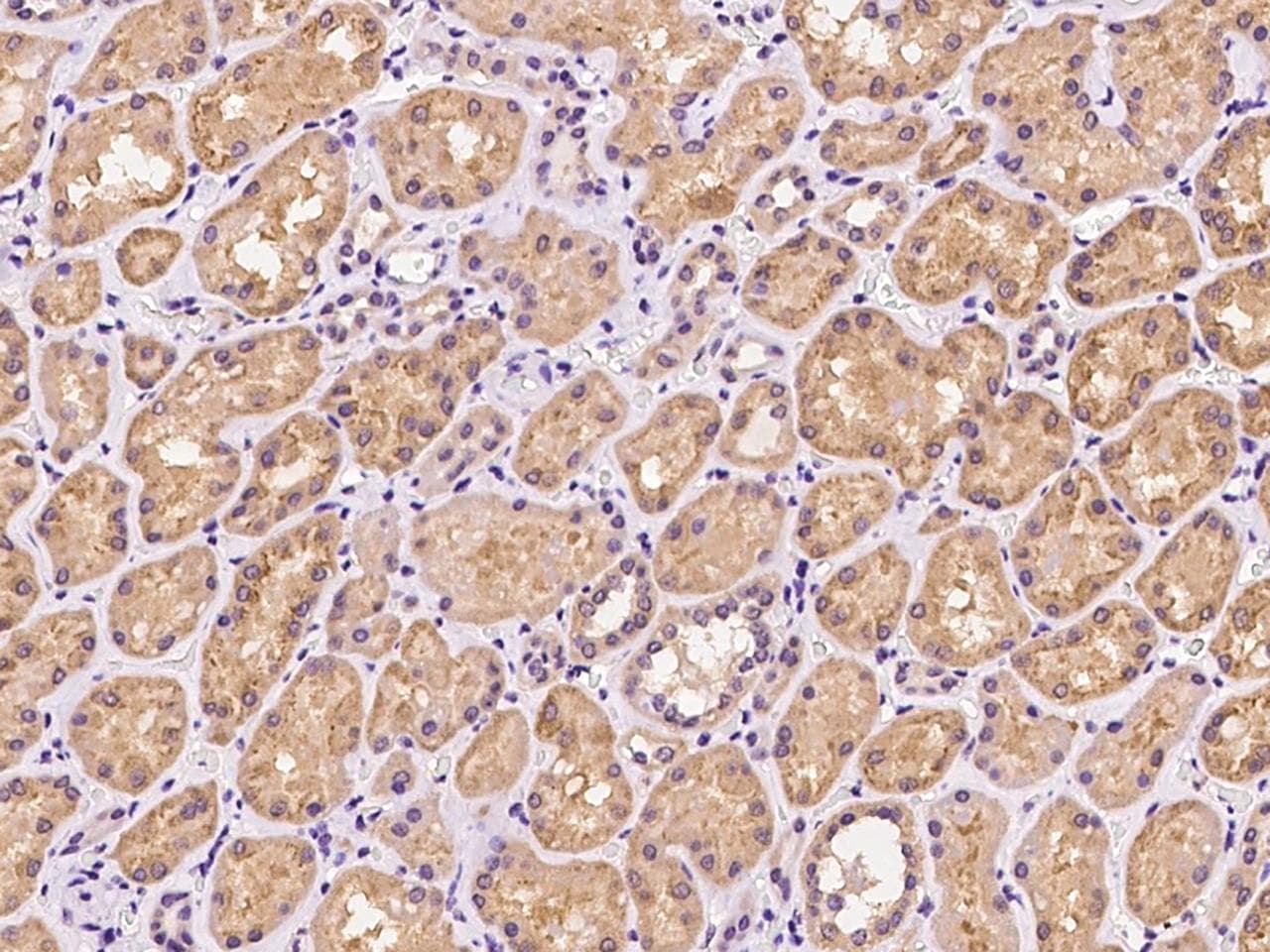 BCAP / PHF11 Antibody