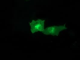 CTDSP1 / SCP1 Antibody (clone OTI1D3)