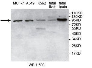 USP5 Antibody (aa2-223)