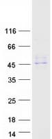 Human SERPINA12 / Vaspin Protein (Recombinant Myc-DDK (Flag))