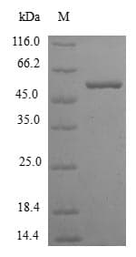 Human KLC3 Protein (Recombinant 6His-SUMO, N-terminus)
