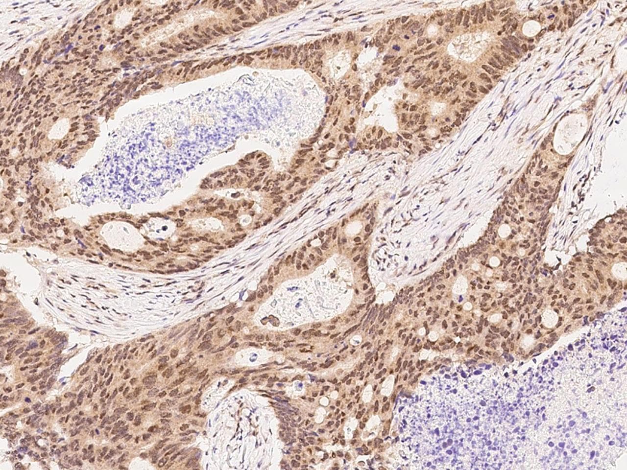 Polyclonal Rabbit anti-Human PTGES3 / p23 Antibody (Preservative Free, IHC)