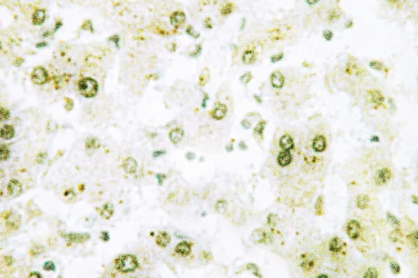 Polyclonal Rabbit anti-Human TOP2A / Topoisomerase II Alpha Antibody (Gln14, IHC, IF, WB)