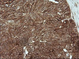 CTNNB1 / Beta Catenin Antibody (clone OTI9C1, Carrier-free)