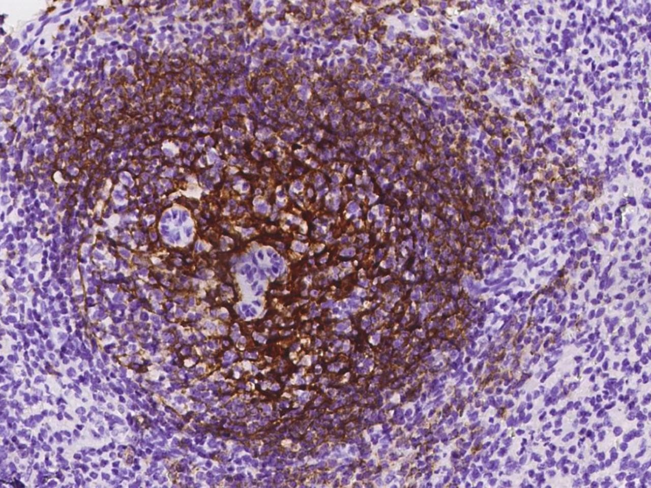 Monoclonal Mouse anti-Human CR2 / CD21 Antibody (clone 28, Preservative Free, IHC)